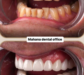 دندانپزشکی ماهانا دنتال