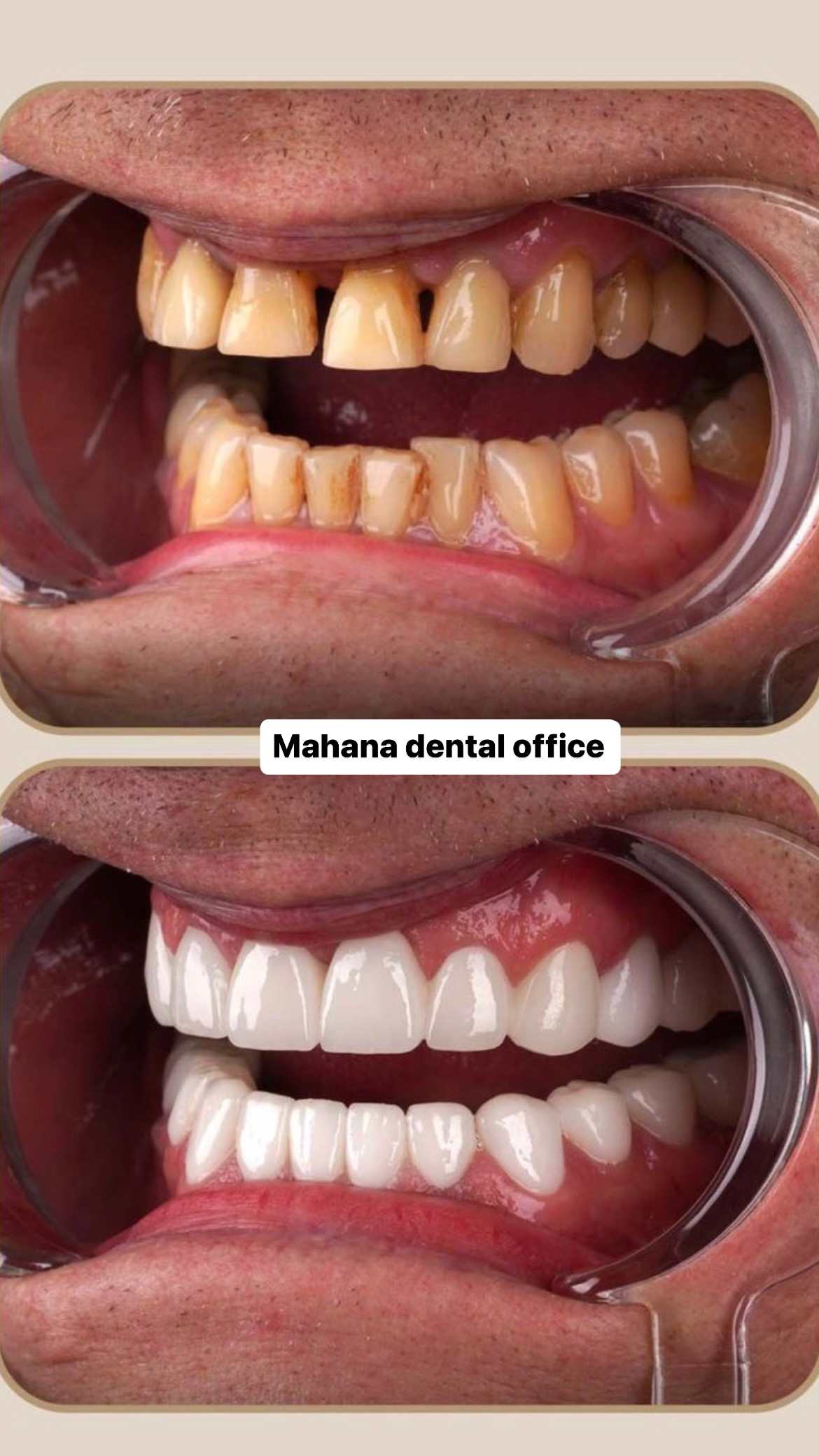 دندانپزشکی ماهانا دنتال