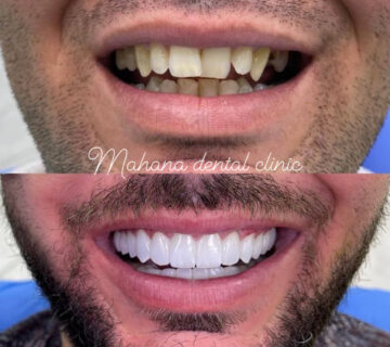 دندانپزشکی ماهانا