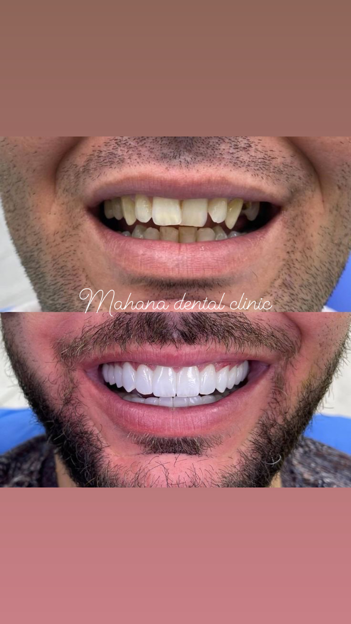 دندانپزشکی ماهانا