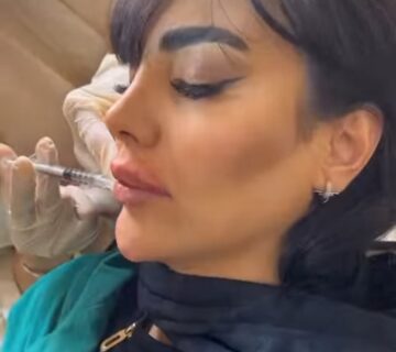 تزریق لب روسی