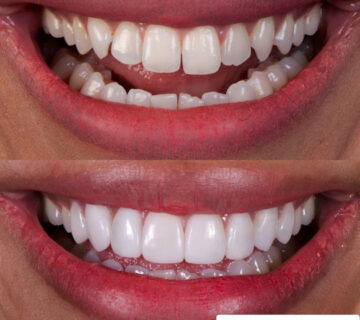 خط لبخند دندانپزشکی ماهانا