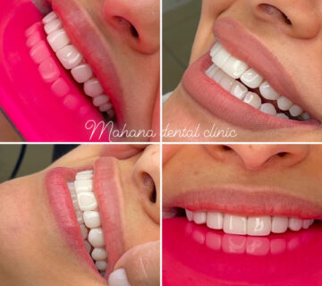 دندانپزشکی ماهانا