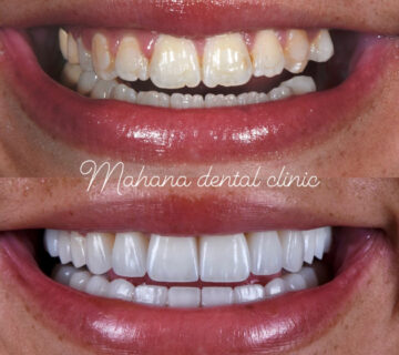 دندانپزشکی ماهانا