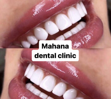 دندانپزشکی ماهانا