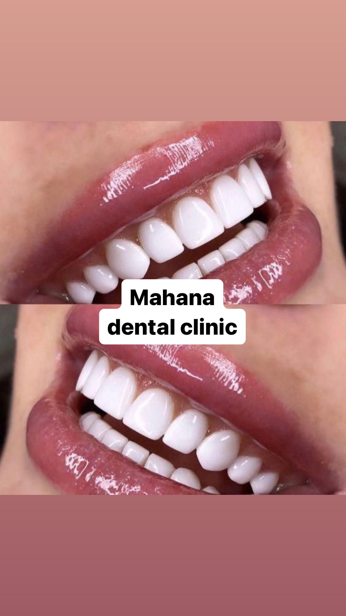 دندانپزشکی ماهانا