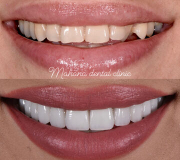 دندانپزشکی ماهانا