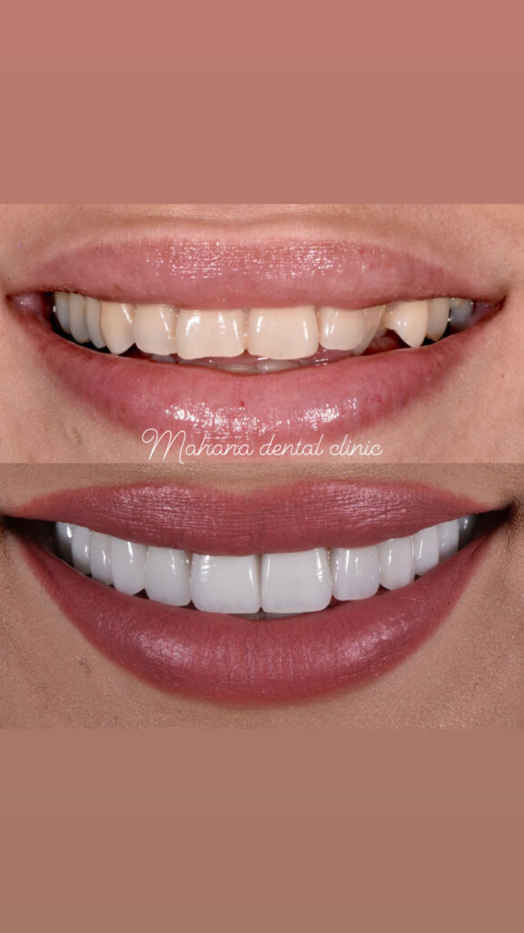 دندانپزشکی ماهانا