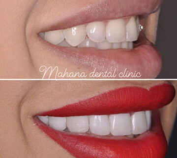 دندانپزشکی ماهانا