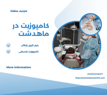 کامپوزیت دندان در ماهدشت کرج