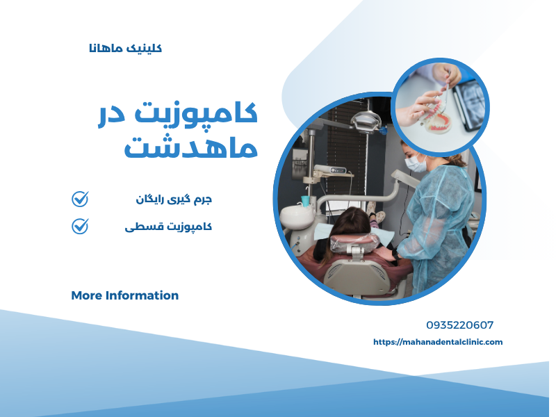 کامپوزیت دندان در ماهدشت کرج