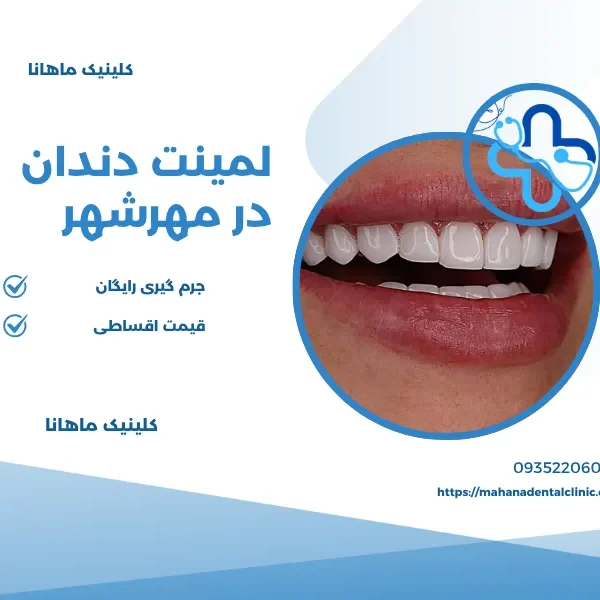 لمینت دندان در مهرشهر کرج