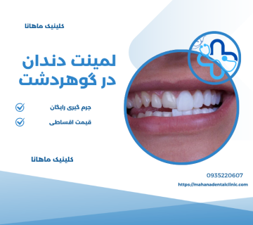 لمینت دندان در گوهردشت