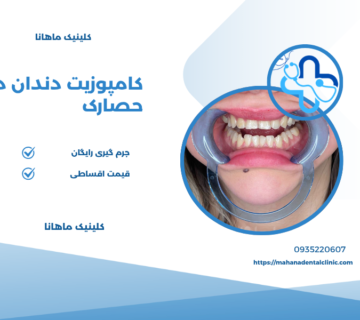 کامپوزیت دندان در حصارک