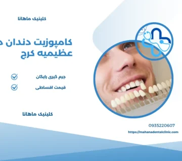 کامپوزیت دندان در عظیمیه کرج