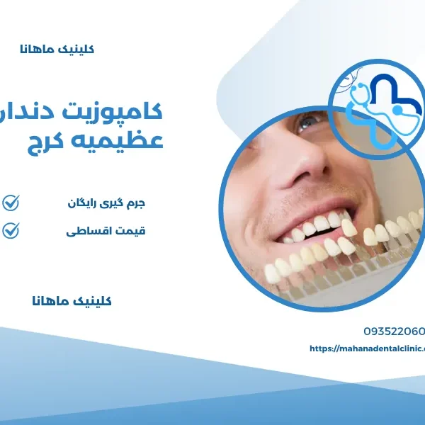 کامپوزیت دندان در عظیمیه کرج