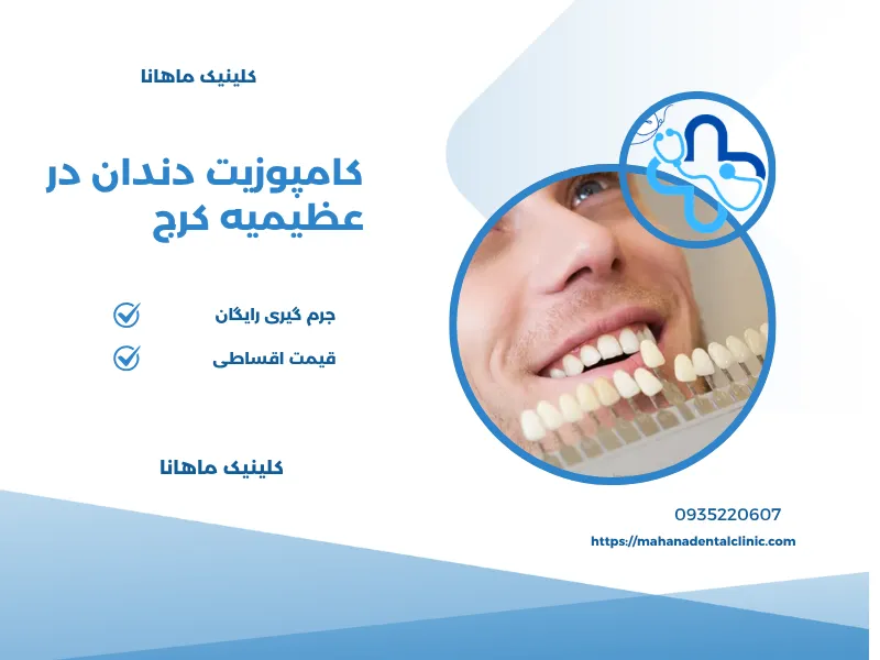کامپوزیت دندان در عظیمیه کرج