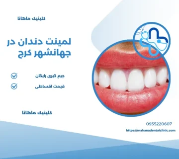 لمینت دندان در جهانشهر
