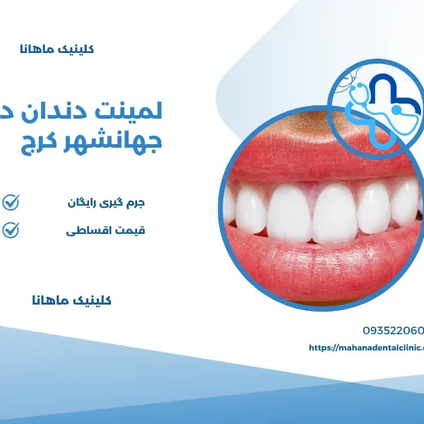 لمینت دندان در جهانشهر