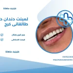 لمینت دندان در طالقانی کرج