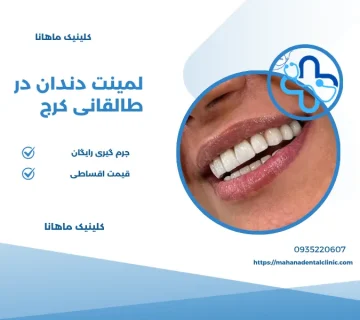 لمینت دندان در طالقانی کرج