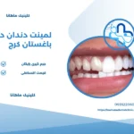 لمینت در باغستان