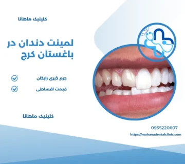 لمینت در باغستان