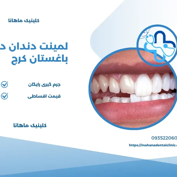 لمینت در باغستان
