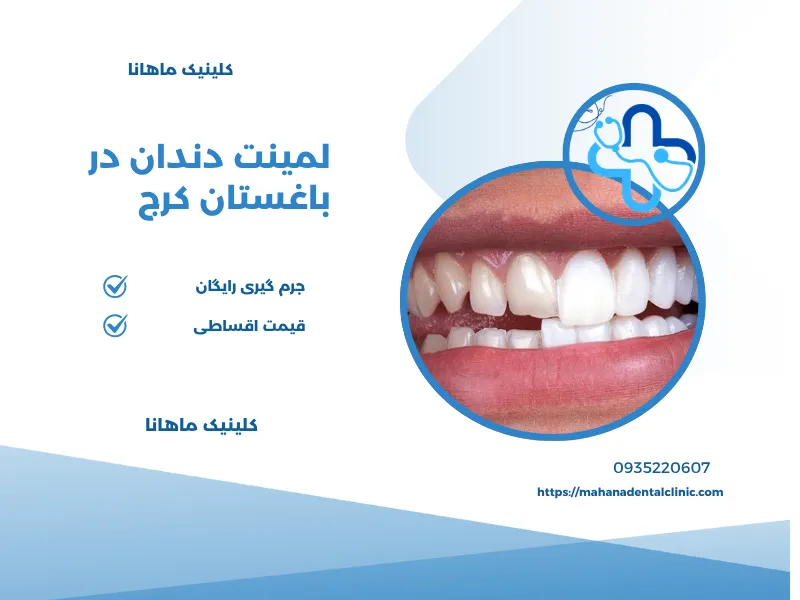 لمینت در باغستان