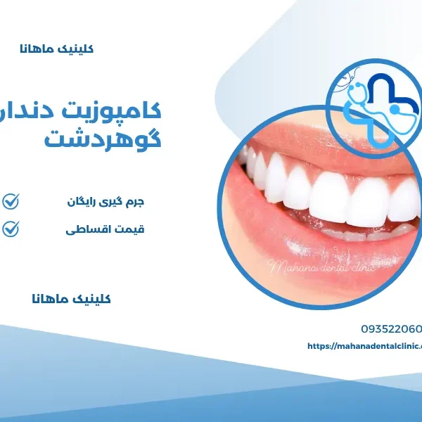 کامپوزیت دندان در گوهردشت