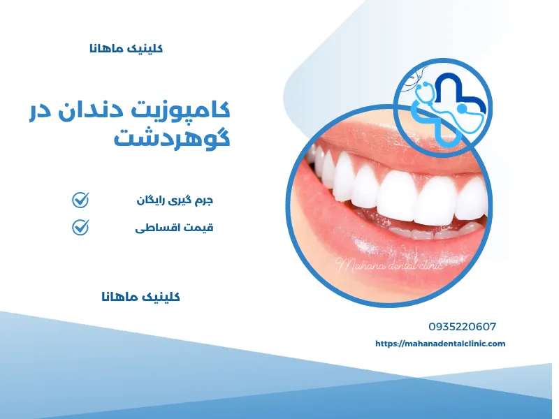 کامپوزیت دندان در گوهردشت