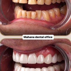 دندانپزشکی ماهانا دنتال