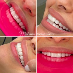 دندانپزشکی ماهانا خدمات دندانپزشکی