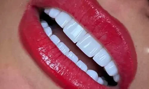 هیبریدی 3 هیبریدی 3