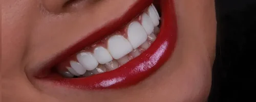 هیبریدی 5 هیبریدی 5